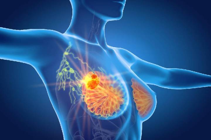 Mapeamento genético avança como aliado na prevenção do câncer de mama e ganha força no debate público