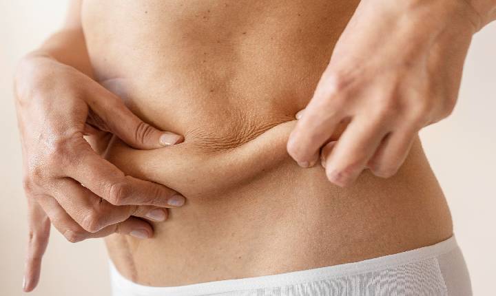 Tecnologia melhora retração da pele após lipoaspiração