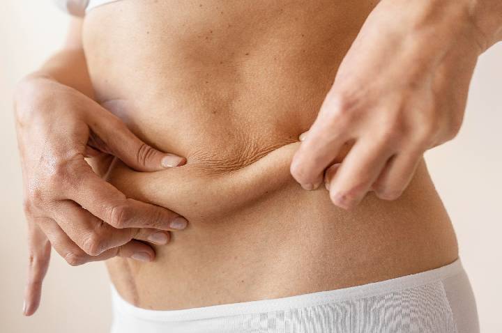 Tecnologia melhora retração da pele após lipoaspiração