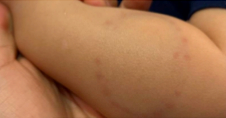 Auxiliar de berçário morde bebê em Uberlândia e é demitida por justa causa