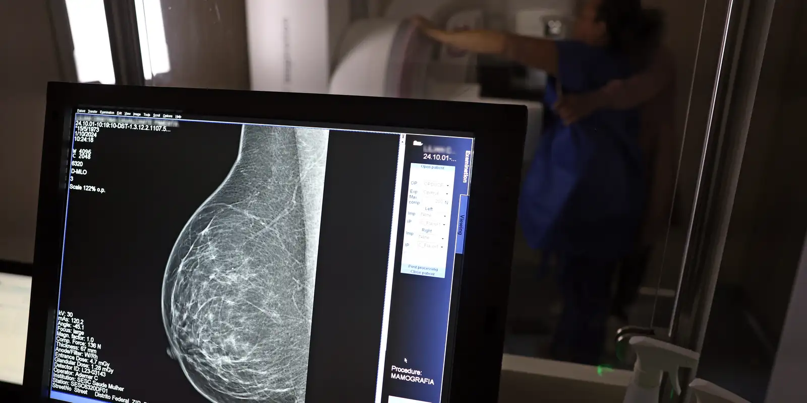 Plano de saúde terá que cobrir mamografia digital para todas as idades