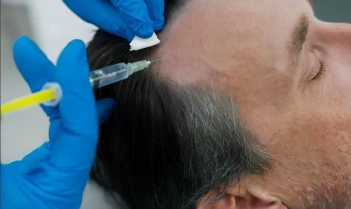 Cuidado capilar masculino ganha espaço nos consultórios dermatológicos