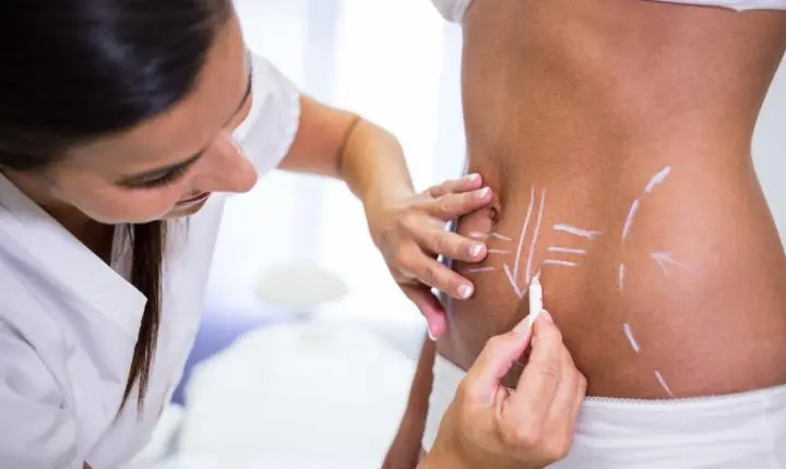 Lipo HD amplia possibilidades da definição corporal